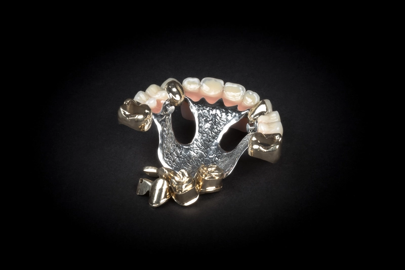 R&V Qualitätszahntechnik - Dentallabor - ein gegossenes Metallgerüst für eine herausnehmbare Teilprothese,