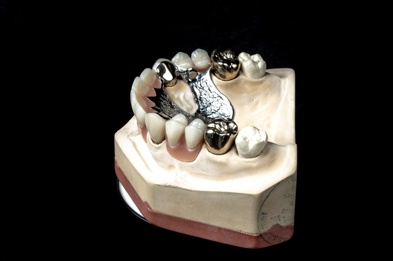 R&V Qualitätszahntechnik - Dentallabor - ein gegossenes Metallgerüst für eine herausnehmbare Teilprothese,