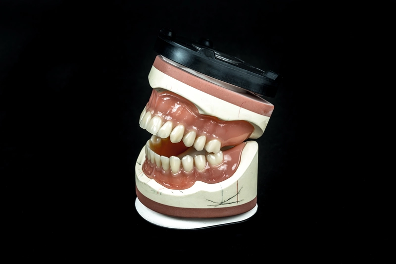 R&V Qualitätszahntechnik - Dentallabor - Anti-Schnarch-Mundstück