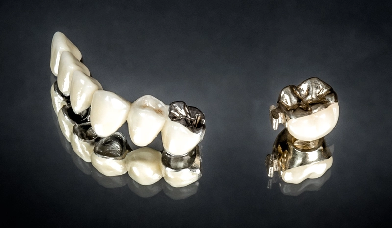 R&V Qualitätszahntechnik - Dentallabor - ein gegossenes Metallgerüst für eine herausnehmbare Teilprothese,